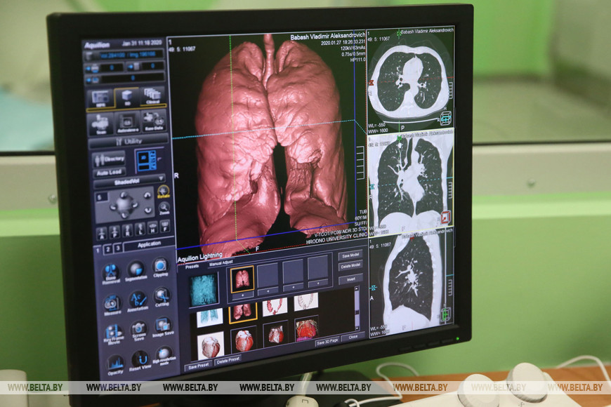 В Лидскую ЦРБ поступит новый компьютерный томограф в 2020 году